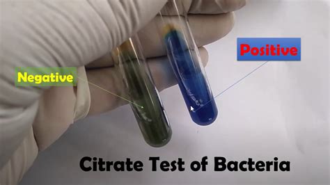 citrate utilization test